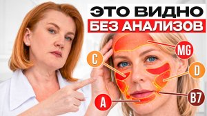 Врач объясняет как УВИДЕТЬ дефициты витаминов БЕЗ АНАЛИЗОВ! Проверьте себя