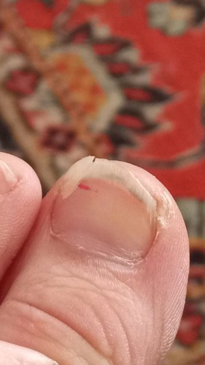 Сломала ноготь! 😮