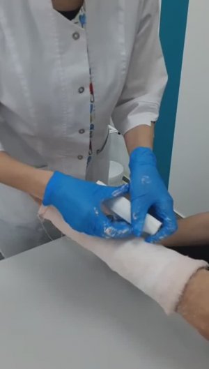 Наложение гипсовой лангеты