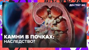 Камни в почках: причины, симптомы, наследственность и лечение | Доктор 24