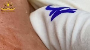 Asmr. Чистим кожу от черных точек. #005