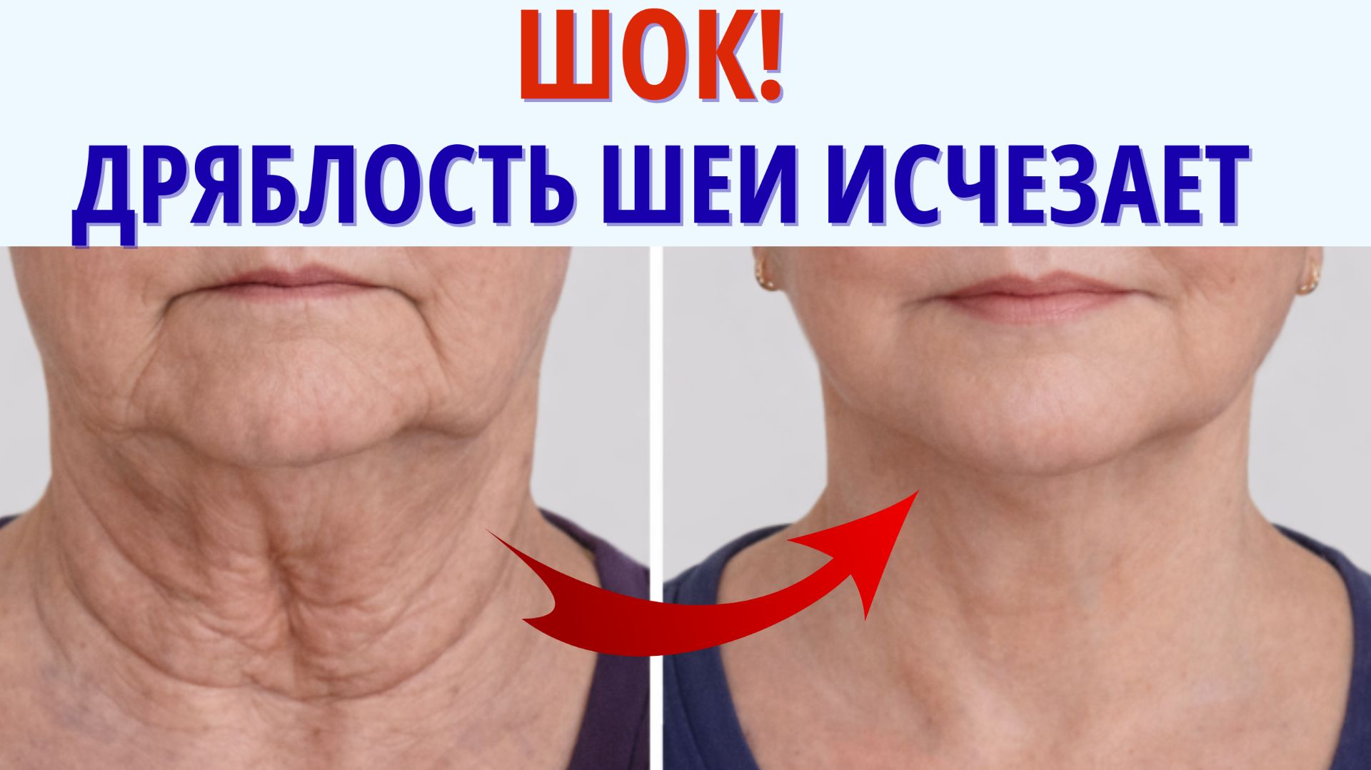 Ушла ДРЯБЛОСТЬ шеи! Как ПОДТЯНУТЬ ШЕЮ за 10 мин в день