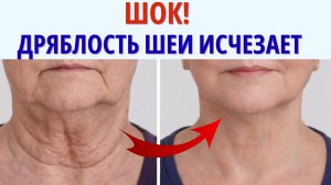Ушла ДРЯБЛОСТЬ шеи! Как ПОДТЯНУТЬ ШЕЮ за 10 мин в день