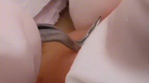 Чистка лица от угрей и акне. Выдавливание прыщей. Удаление черных точек и комедонов