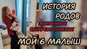 Мои 6 роды 💙 экстренное кесарево 🤰🏼 что лучше ЕР или КС
