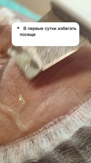 правила после чистки лица.mp4 смотреть онлайн