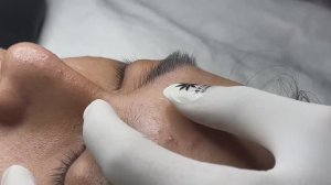 Asmr. Механическое очищение от сальных пробок. #107(Linh)P1