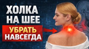 Холка и горб на спине: почему не помогают массажи и «вправление» позвонков.