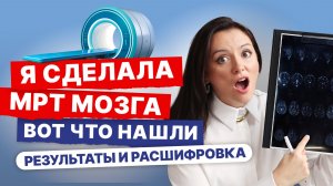 Я этого не ожидала: что показало МРТ мозга после беременности? Разбираю свои результаты как невролог