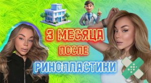 3 МЕСЯЦА ПОСЛЕ РИНОПЛАСТИКИ🔪