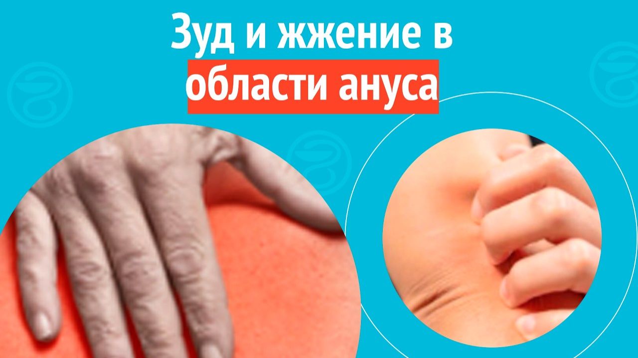 😲 Зуд и жжение в области ануса. Клинический случай № 1743