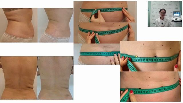 Елена Монахова - Подготовка и коррекция фигуры (17 февраля 2026)