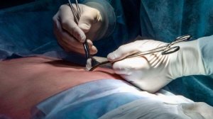 «Дикие боли»: жительница Тулы судится с хирургом из Петербурга