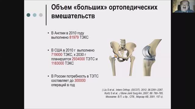 Анестезия и анальгезия при протезировании суставов нижних конечностей.mp4 смотреть онлайн