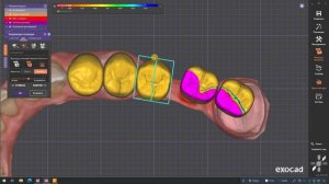 Правильно делаем мост с большим промежутком