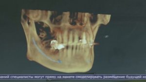 26.02.2026 В стоматологической клинике «Ровидент» появился современный рентген-кабинет