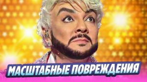 Жуткий ожог на руке Киркорова напугал поклонников 🔥 Новости Шоу-Бизнеса