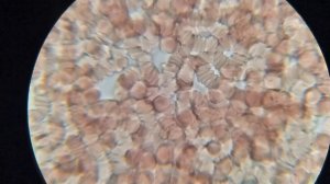 Кровь после растворимого кофе