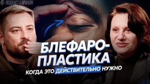 Секреты успешной блефаропластики | Подготовка к операции, реабилитация и естественный результат