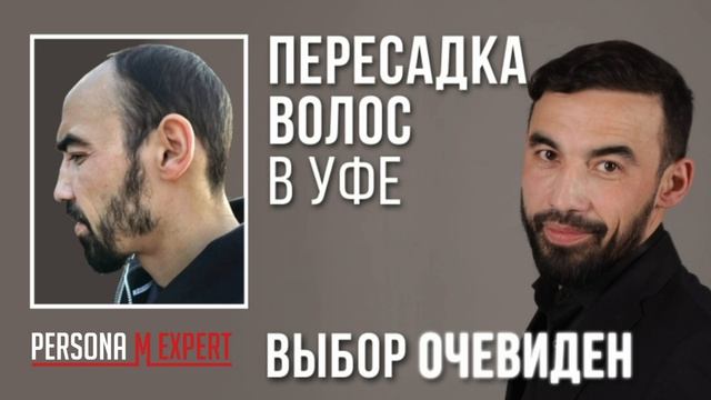 Выбор очевиден