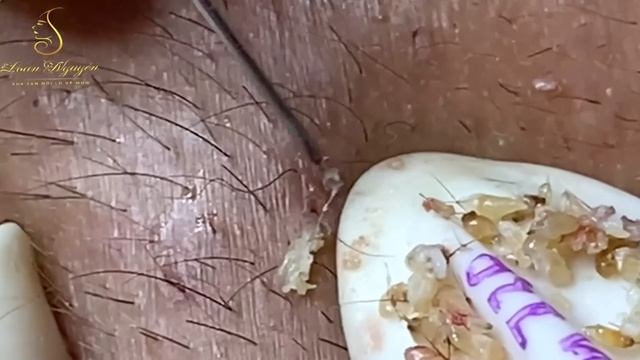 Осторожно! Шокирующая правда о чистке лица