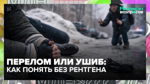 Как отличить перелом от ушиба? | Миллион вопросов — Москва 24