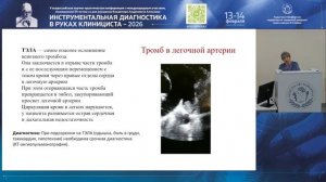 Тромбоэмболические осложнения в эхокардиографической практике.