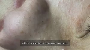 Asmr. Профессиональное избавление от сальных пробок 𝟗𝟎361