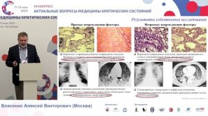 Гипергидратация легких и патогенез гипоксемической ОДН Власенко А.В. 2025