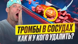 Как удаляют тромб при инсульте? Сложно ли стать и быть врачом?