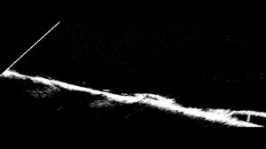 Lowrance Active Target На каряге-4 ВВ