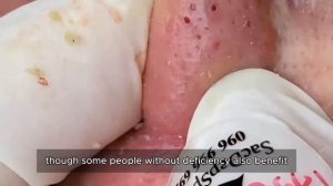 Механическое очищение пор от черных точек: техника #𝟗𝟎449