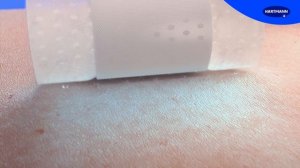 С Сosmopor Silicone снимать повязку совсем не больно!