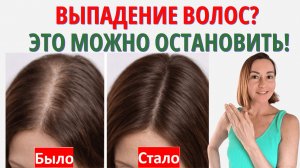 Как ОСТАНОВИТЬ ВЫПАДЕНИЕ волос? Вы УДИВИТЕСЬ, но это работает. Секрет густых волос в любом возрасте