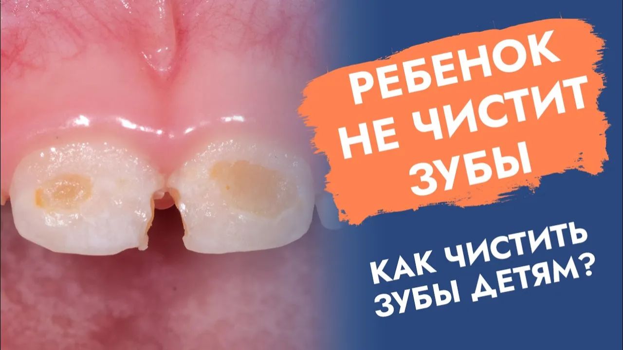 Как приучить ребенка чистить зубы?