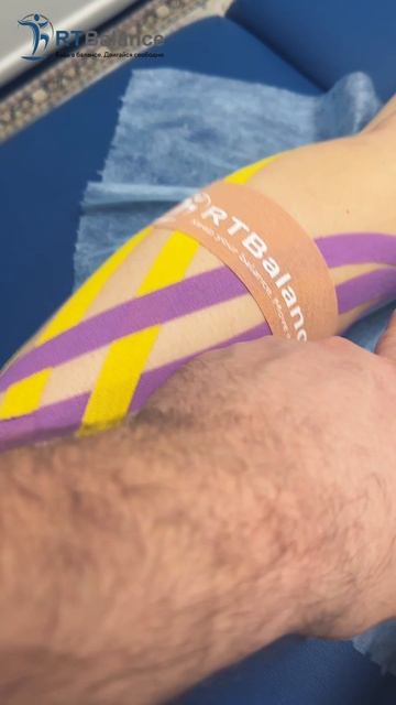 Тейпирование голени при тяжести и боли в ногах