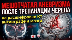 МЕШОТЧАТАЯ АНЕВРИЗМА головного мозга АТЕРОСКЛЕРОЗ после операции трепанации черепа на КТ расшифровке