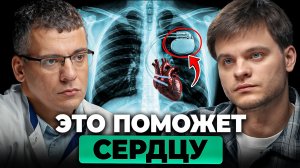 Ты должен знать ЭТО о кардиостимуляторе! Как он работает и кому нужен?Тамаз Гаглошвили, Глеб Соломин