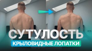 Как убрать крыловидные лопатки? Избавляемся от сутулости