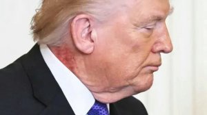 Трамп появился на мероприятии в Белом доме с крупным раздражением на шее