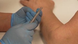 Артроз? Поставь пчелу. Как одна пчела запускает капилляры мозга и лечит суставы