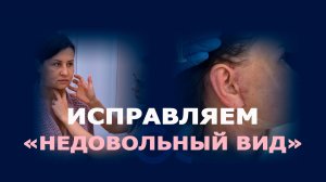 Омоложение лица в 54 года: SMAS-лифтинг с коррекцией шеи