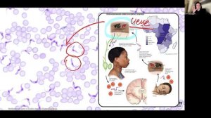 Паразитические простейшие