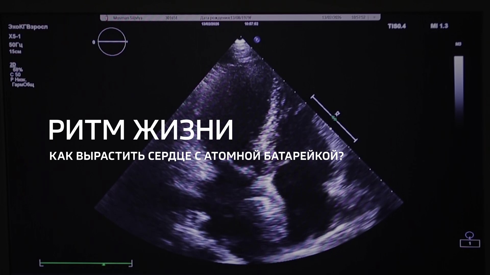 Ритм сердца. Как вырастить сердце с атомной батарейкой?