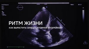 Ритм сердца. Как вырастить сердце с атомной батарейкой?