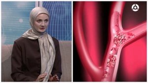 Час здоровья. Инсульт