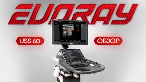 Обзор EVORAY USS 60: один ультразвуковой аппарат для всей клиники