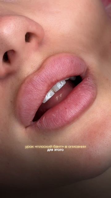 Неправильный массаж после увеличения губ портит форму