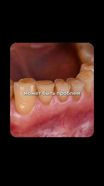 Почему у людей неправильный прикус-