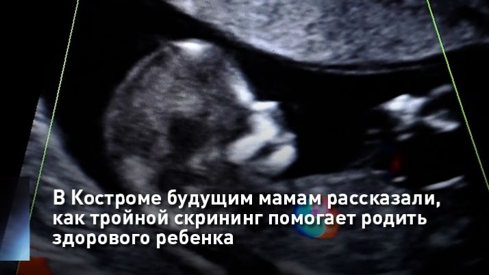 В Костроме будущим мамам рассказали, как тройной скрининг помогает родить здорового ребенка